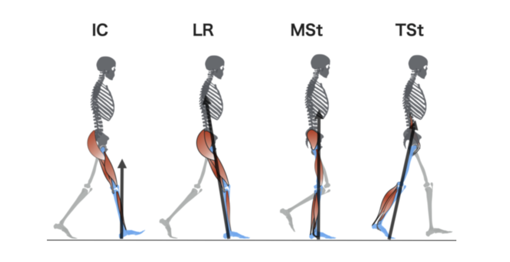 歩行時痛の評価についての説明画像
